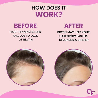 Carbamide Forte Biotin Tablets for Hair Growth | Biotin Supplement with 50 Multivitamin Ingredients for Women & Men | Hair Supplements for Women & Men | Hair Growth Tablets - 90